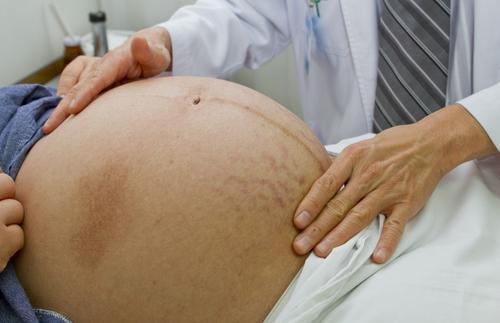 ARVI durante el embarazo. ¿Qué necesito saber?