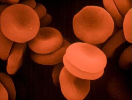 ¿Qué aumenta la hemoglobina mejor?