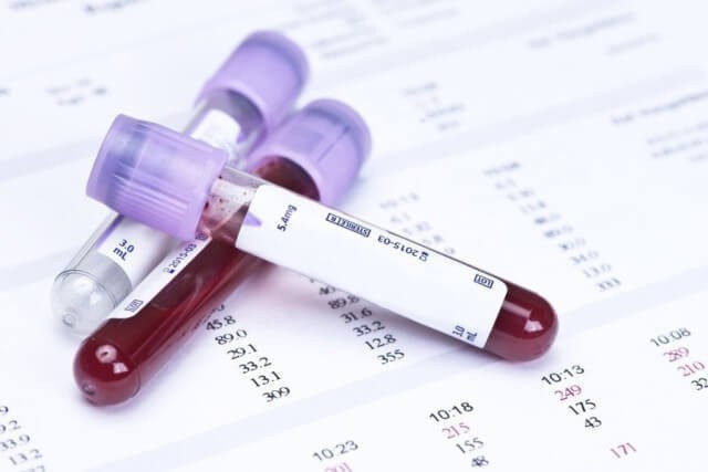 ¿Cómo pasar un análisis de sangre para determinar la esterilidad?