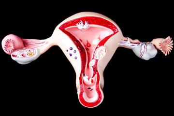 Agrandamiento del útero: causas y signos principales